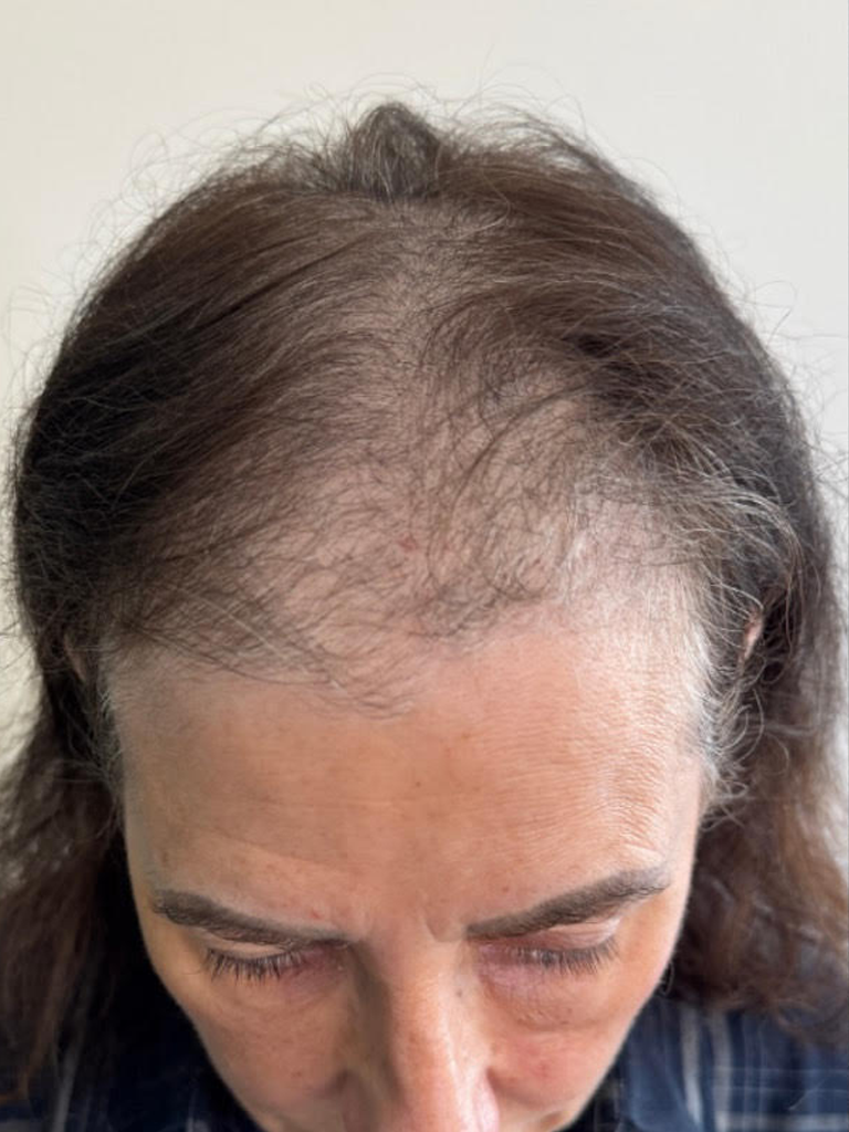 Patient Case #14680 — before