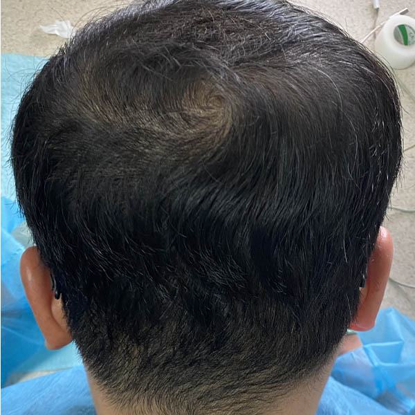 Patient Case #11859 — after