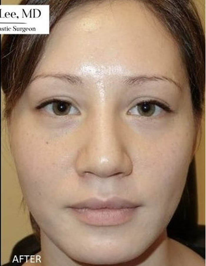 Patient Case #12666 — after