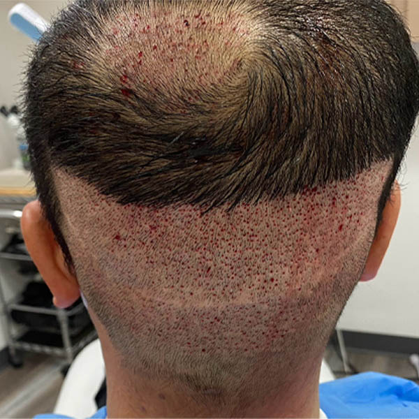 Patient Case #11859 — before