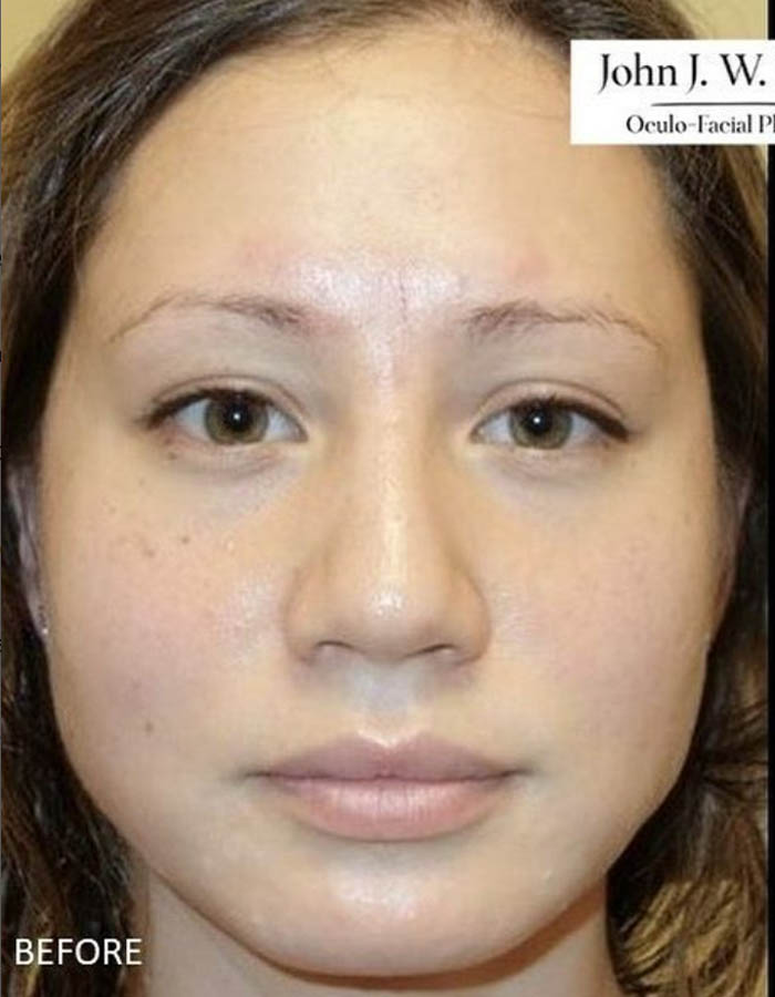 Patient Case #12666 — before
