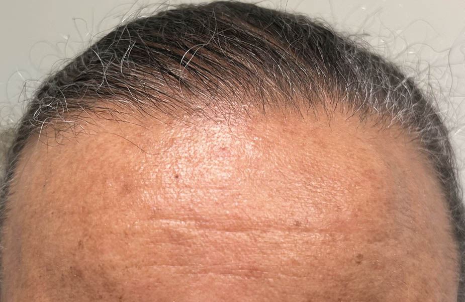 Patient Case #11874 — after