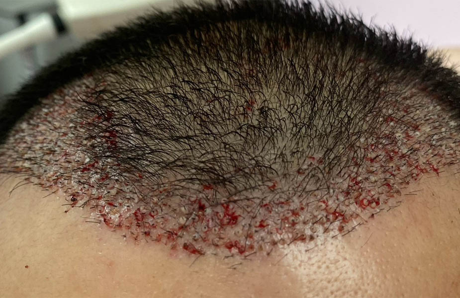 Patient Case #11871 — after