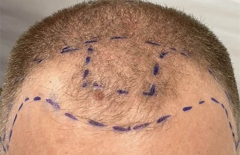 Patient Case #11868 — before