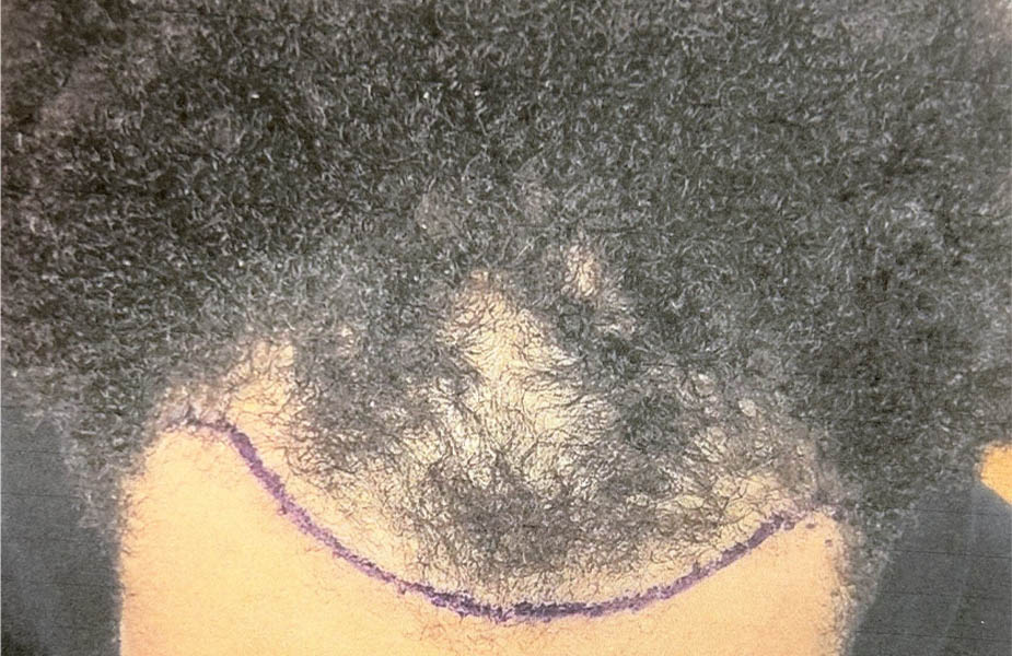 Patient Case #11877 — before