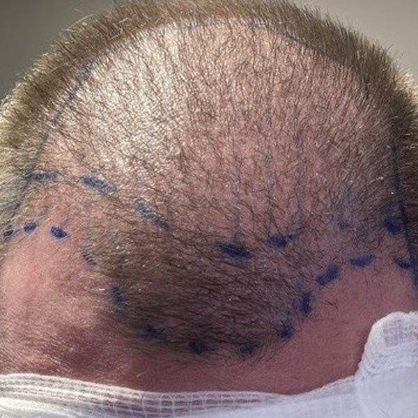 Patient Case #11862 — before