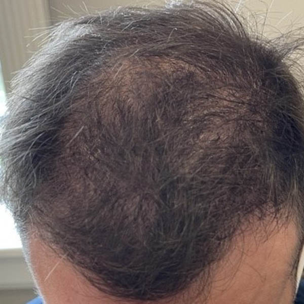 Patient Case #11862 — after