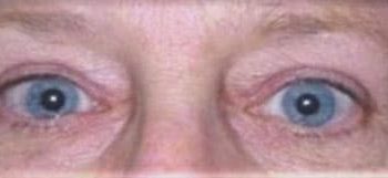 Patient Case #10952 — after