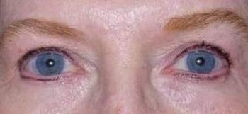Patient Case #10949 — after
