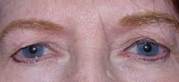 Patient Case #10949 — before