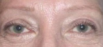 Patient Case #10928 — after