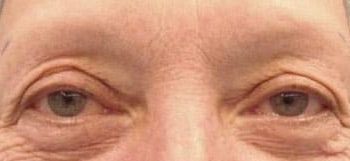 Patient Case #10928 — before