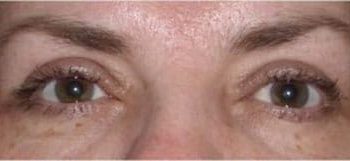 Patient Case #10925 — after