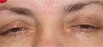 Patient Case #10925 — before