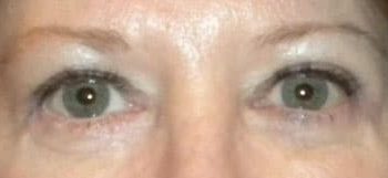 Patient Case #10931 — after