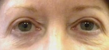 Patient Case #10931 — before