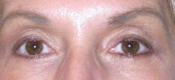 Patient Case #10921 — after