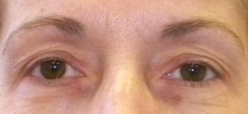 Patient Case #10921 — before