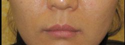 Patient Case #10643 — after