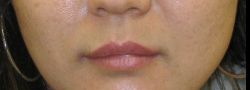 Patient Case #10643 — before
