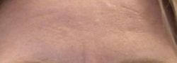 Patient Case #10646 — before
