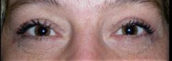 Patient Case #10851 — after