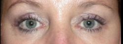 Patient Case #10896 — after