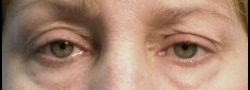 Patient Case #10896 — before