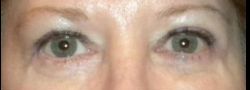 Patient Case #10893 — before