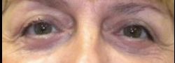 Patient Case #10899 — after