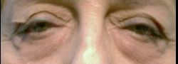 Patient Case #10899 — before