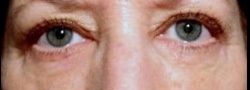 Patient Case #10902 — after