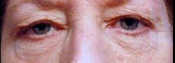 Patient Case #10902 — before