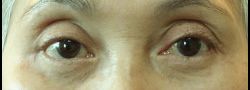 Patient Case #10905 — after