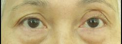 Patient Case #10905 — before
