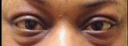 Patient Case #10854 — before