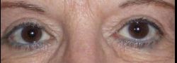 Patient Case #10857 — after