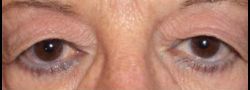 Patient Case #10857 — before