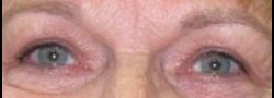 Patient Case #10860 — after