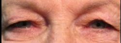 Patient Case #10860 — before
