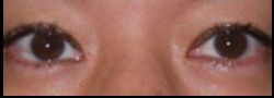 Patient Case #10863 — after