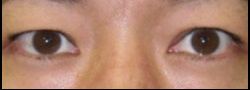 Patient Case #10863 — before