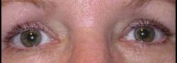 Patient Case #10914 — after