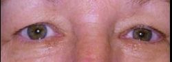 Patient Case #10914 — before