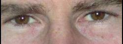 Patient Case #10872 — after
