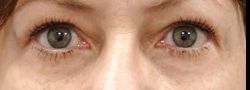 Patient Case #10875 — after