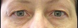 Patient Case #10875 — before