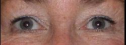 Patient Case #10878 — after