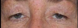 Patient Case #10878 — before
