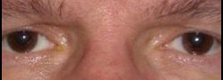 Patient Case #10881 — after